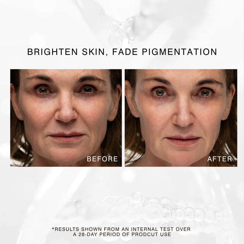 Exo C Booster before and after showing pigmentation reduction and brighter complexion