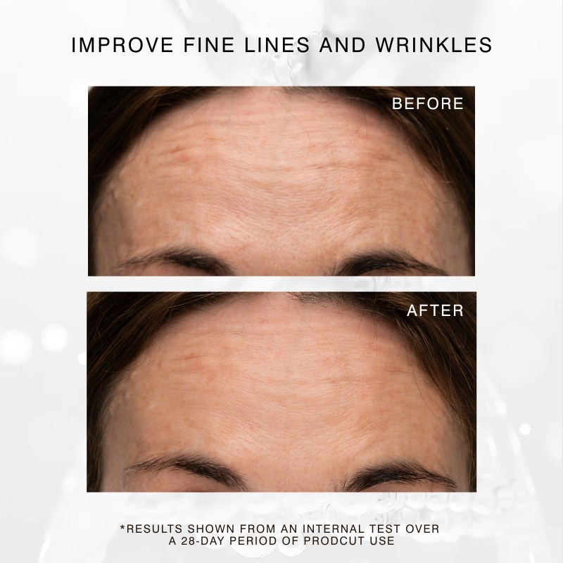 Before and after results of Exo C Booster showing reduced fine lines on the forehead