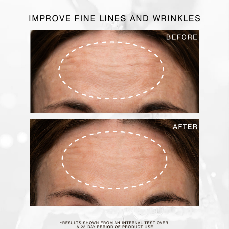 Before and after showing results of Dr Sebagh Exo C Booster improving wrinkles and fine lines