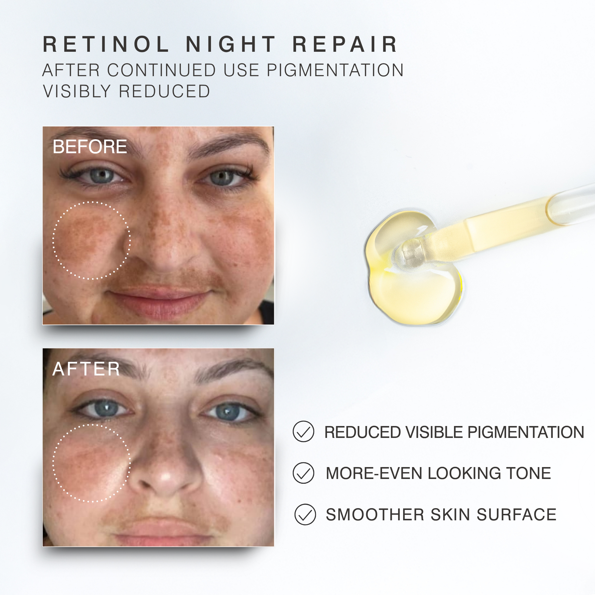 Promotional graphic for Dr Sebagh's Retinol night repair skincare product. The layout includes text reading 'RETINOL NIGHT REPAIR' and 'AFTER CONTINUED USE PIGMENTATION VISIBLY REDUCED,' with two close-up facial before/after photos on the left, a dropper of pale yellow serum on the right, and three benefit bullet points about reduced pigmentation, even tone, and smoother skin.