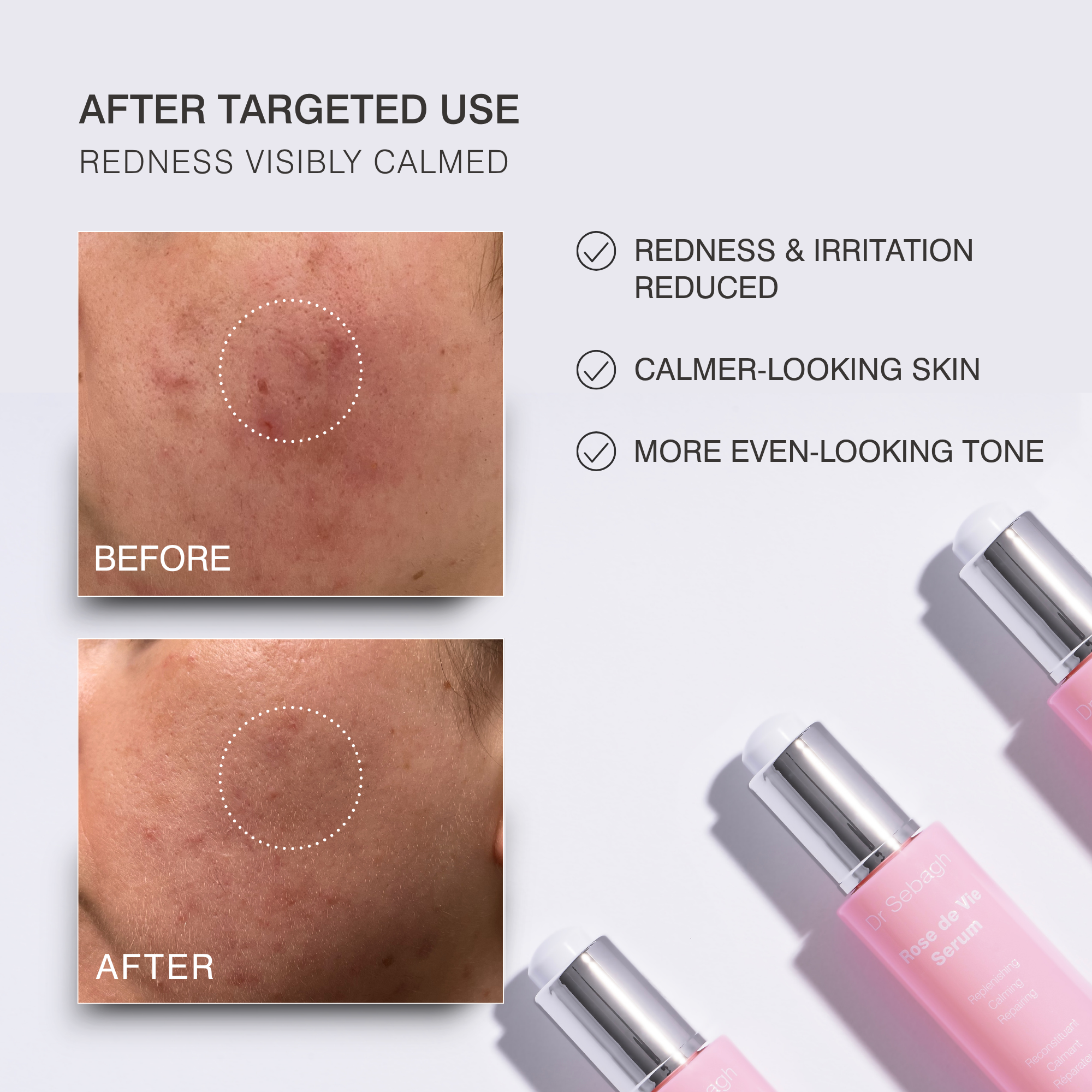 Dr Sebagh Rose de Vie Before-and-after skin comparison showing redness reduction on human skin, with text reading 'AFTER TARGETED USE' and three benefit points, plus pink cosmetic bottles with silver caps arranged on a light gray background.
