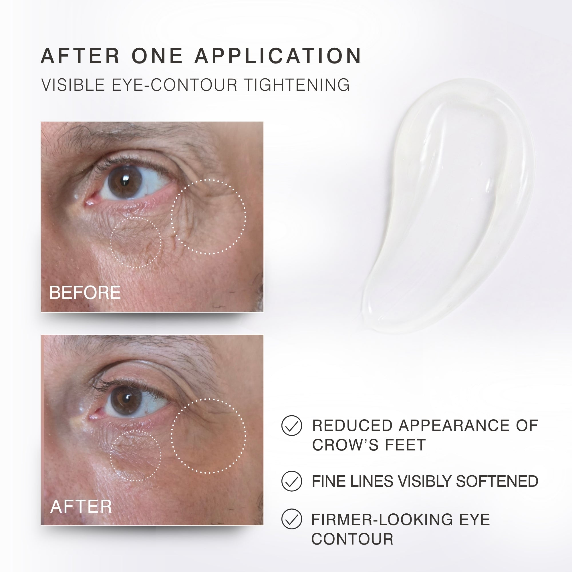 Instant Eye Lift Gel before and after under eye transformation
