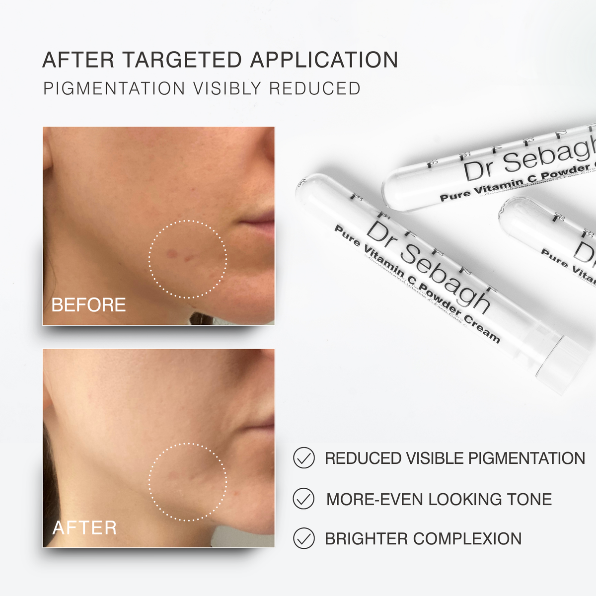 Dr Sebaghs Pure Vitamin C Powder Cream Before-and-after comparison showing a person's cheek and jawline area with reduced visible pigmentation, alongside three white Dr Sebagh cream tubes on a light grey background with text describing results.