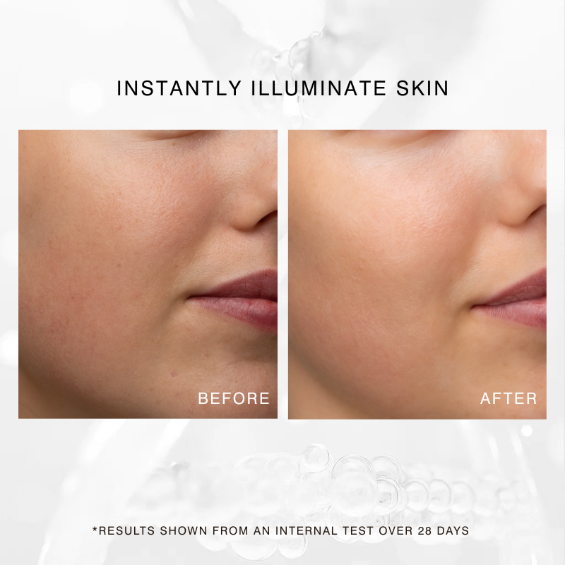 Before and after results showing improved skin radiance and luminosity after using Dr Sebagh Exo C Booster serum