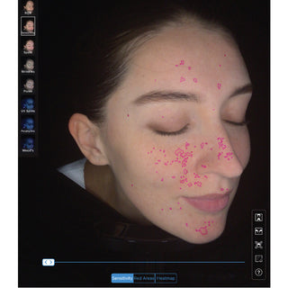 Dr Sebagh Skin Analysis