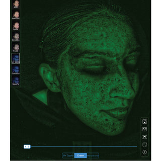 Dr Sebagh Skin Analysis
