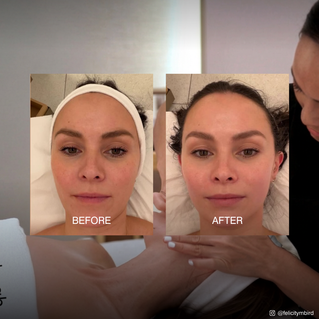 Model showing the before and after effects of the Dr Sebagh Signature Facial at Harrods