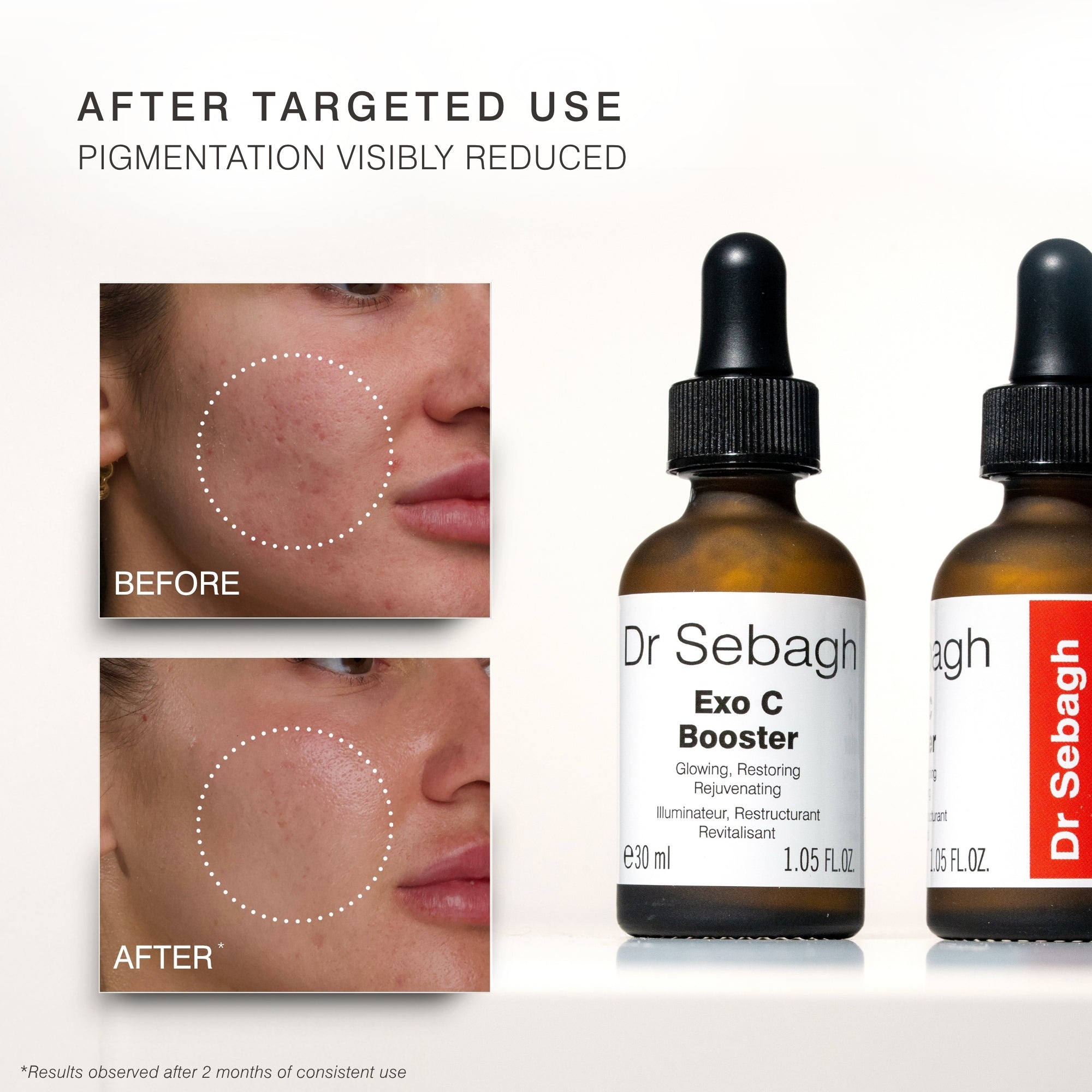 Dr Sebagh Exo C Booster skincare dropper bottle shown beside before-and-after facial skin close-ups demonstrating reduced pigmentation. Text at the top reads 'AFTER TARGETED USE PIGMENTATION VISIBLY REDUCED.