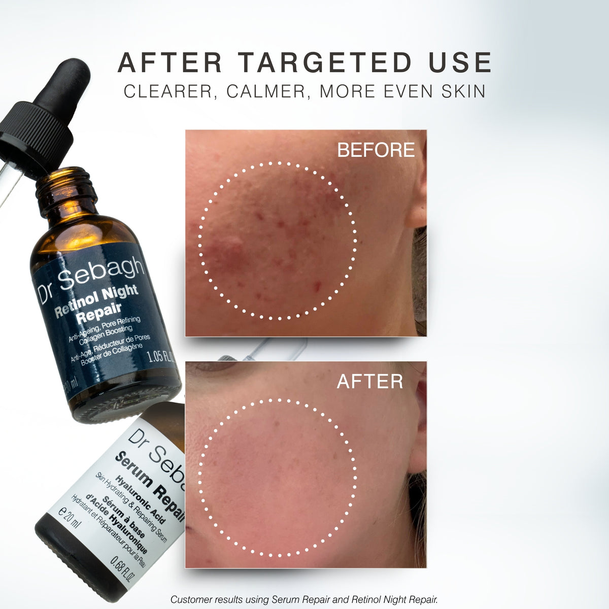 Dr Sebagh Retinol Night Repair and Serum Repair skincare bottles shown beside before-and-after skin close-ups on a light gray background with promotional text.