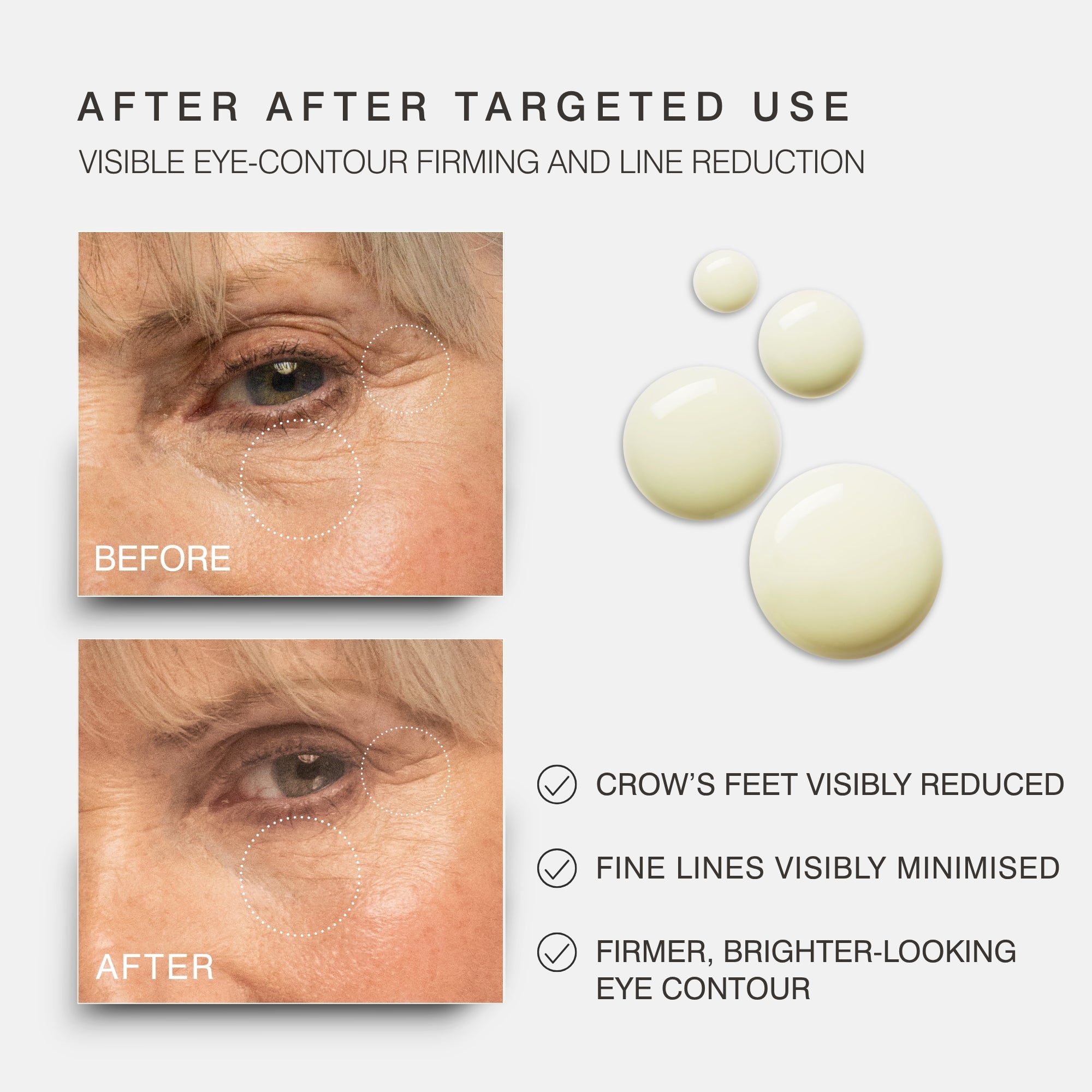 Before-and-after comparison of an older woman's eye area showing reduced crow's feet and fine lines, alongside three texture shot and text highlighting visible eye-contour firming and line reduction after targeted use.